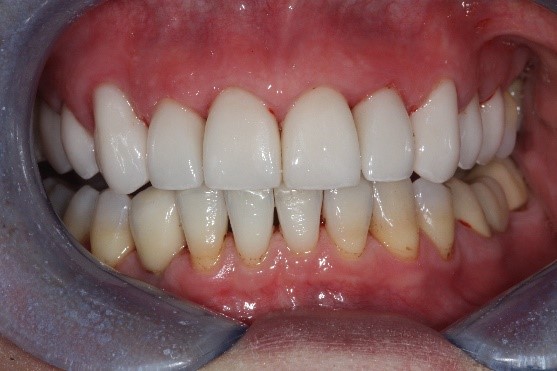 Orthodontic - Synergy Dental