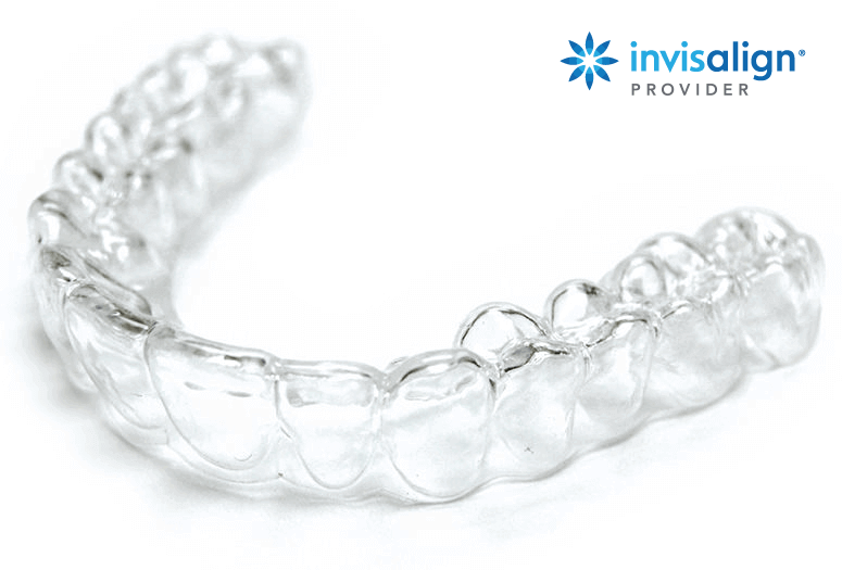 Invisalign – Invisible Braces - Total Smiles Dentistry Richmond Virginia